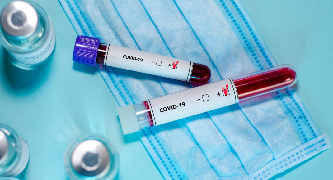 На Луганщині зафіксовано 10 нових випадків зараження COVID-19: 5 хворих з Сєвєродонецька
