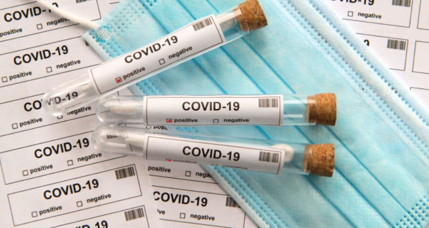 В Україні виявлено 9 832 нових випадки COVID-19 за добу, 94 летальних