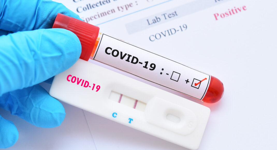 В Украине зафиксировано 11057 новых случаев COVID-19