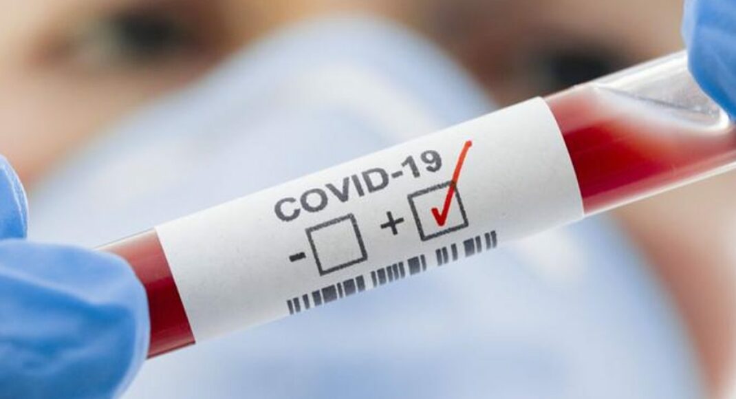 В ОРДО ще 39 людей захворіли на COVID-19