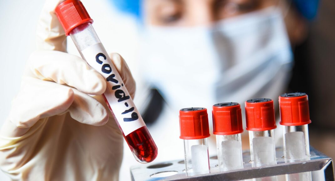 COVID19 діагностували у директора краєзнавчого музею в ОРЛО: наслідки