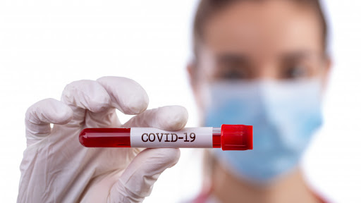 За сутки COVID-19 в Украине обнаружили у 2088 человек: зафиксировано 48 летальных случаев