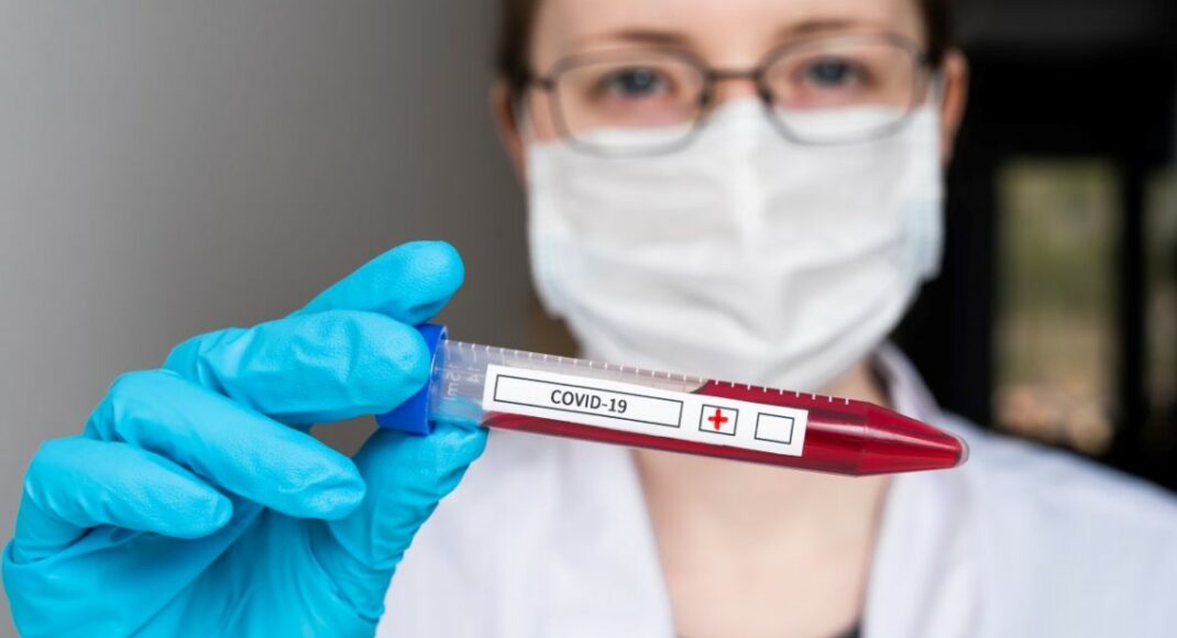 В Україні зафіксовано 16 294 випадки COVID-19