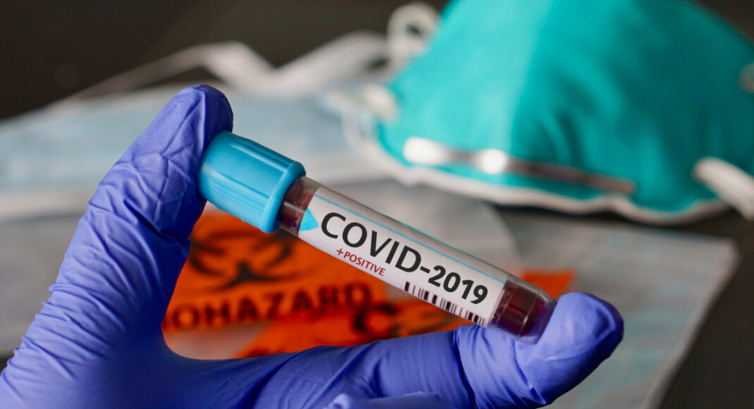 12496 нових випадків COVID-19 виявили в Україні за добу