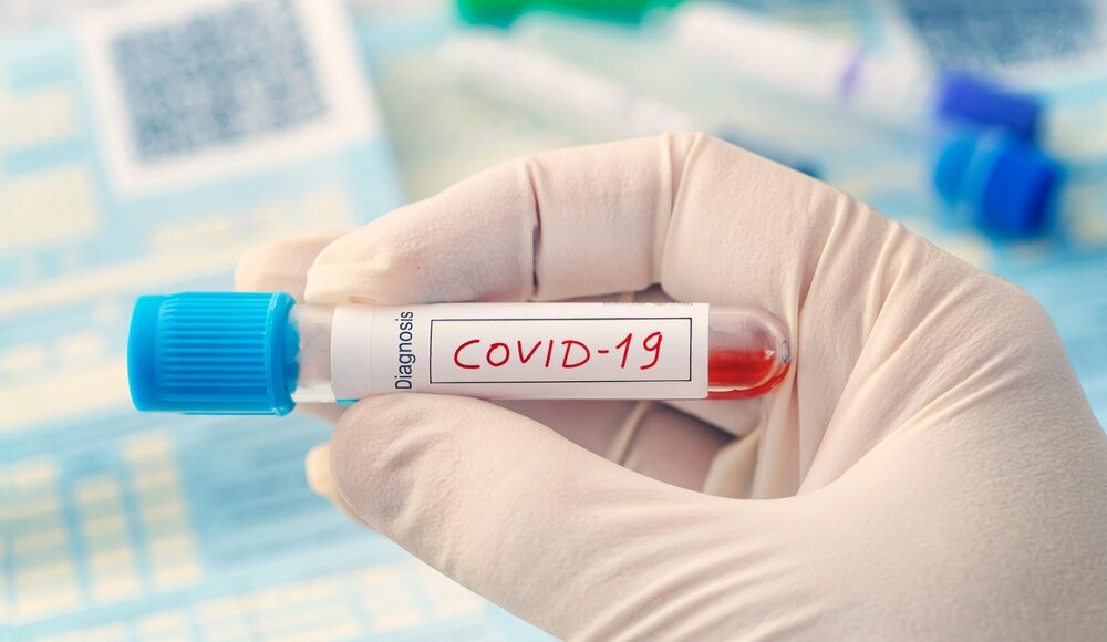 Лаборатории Донетчины сообщили о 187 новых больных COVID-19