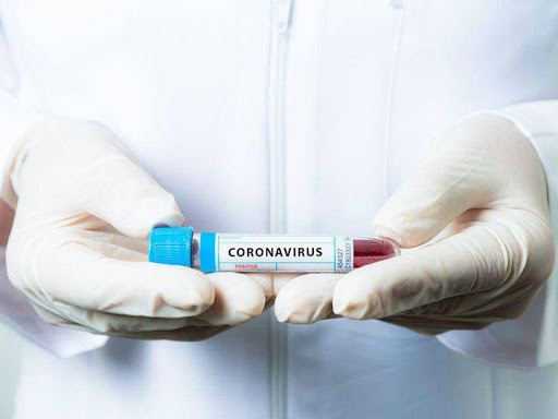 В ОРЛО заявили про 18 нових випадків COVID-19, один летальний