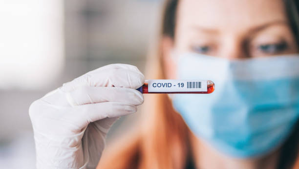 В Донецкой области выявили 1010 новых случаев COVID-19, в Луганской — 255