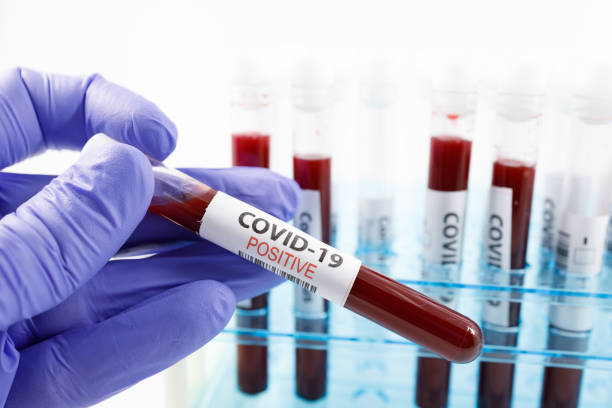 На Донетчине от COVID-19 умерло еще 7 человек за сутки
