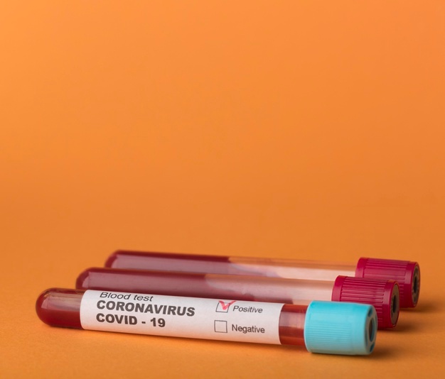 На Луганщині ще 5 людей померли від COVID-19