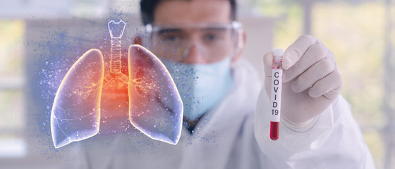 В Донецкой области выявлено 402 новых случаев COVID-19, в Луганской — 37