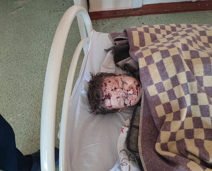 Гайдай рассказал о пострадавшей в результате обстрелов семье из Северодонецка (фото)