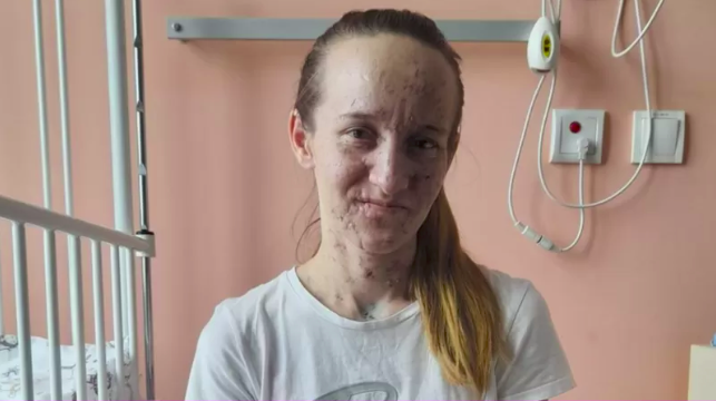 Семье из Луганщины, потерявшей зрение в результате обстрела, проводят сложные операции в Польше: смогут видеть