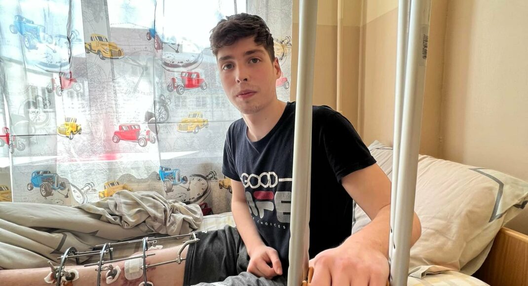 Во Львове врачи спасли ногу подростку-волонтеру из Северодонецка (фото)