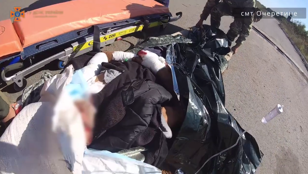 Важкі поранення внаслідок ворожого обстрілу отримав житель Авдіївської громади (відео)