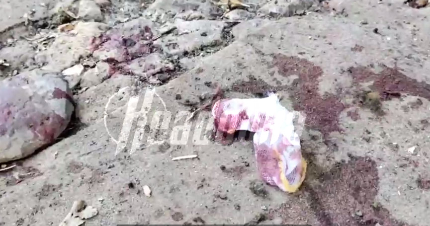 В окупованому Донецьку 10-річній дитині вибухівкою відірвало руку (відео)