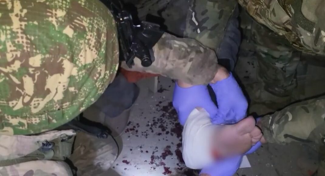 В Красногоровке "Белые ангелы" спасли пожилого мужчину, раненого в результате российского обстрела (видео)