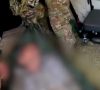 Скончался эвакуированный из Покровска мужчина, который после инсульта две недели лежал без помощи (видео)